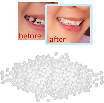 Tpıngfe Geçici Diş Tamir Kiti Moldable Termal Montaj Boncuk Protez Yapıştırıcı Sahte Diş Kozmetik