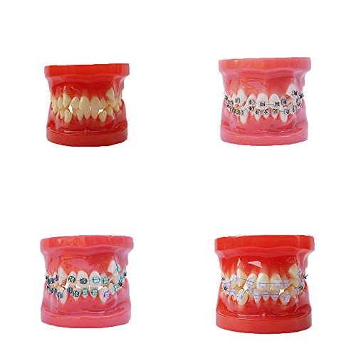 Diş modeli diş modeli diş hekimi patoloji öğretim modeli laboratuvar araştırma öğrenme kullanımı (Yarım metal ve yarım seramik)