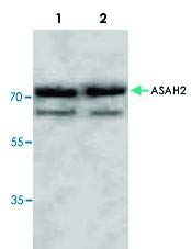 PAB8552-Boyut: 100 mikrogram-Anti-ASAH2 Tavşan Poliklonal Antikoru-Her Biri (100 mikrogram)