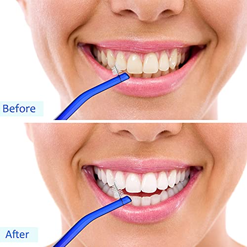 4 Parça Ortodontik Diş Fırçaları İnterdental Fırça V Trim Çift Uçlu Fırça ile İnterproksimal Kafa V Trim Sonu Tutam Diş Fırçası