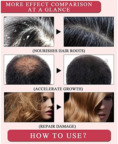 BHUI Zencefil Saç Dökülmesini Önlemek uçucu Yağ,Zencefil Germinal Yağ, Saç Bakımı Çıkma uçucu yağ, Kaybı Saç İnceltme Tedavisi